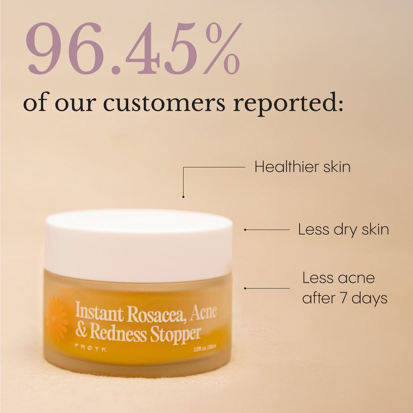 Instant Rosacea, Acne & Redness Stopper