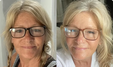 Before and After